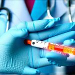 Advanced GI tests that catch problems before they grow