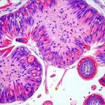Blood markers that reflect gut inflammation