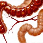 Breath analysis as a quick checkup for the small intestine