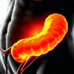 Can Bloating Be a Sign of Pancreatic Enzyme Deficiency?