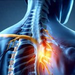 Can GERD Cause Pain Between the Shoulder Blades?