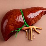 Can Liver Congestion Lead to Digestive Issues?