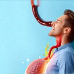 Can You Have Acid Reflux Without Heartburn?