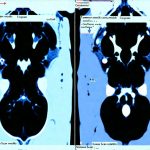 Common scan results that confuse patients