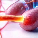 Diagnostics that reveal food-triggered inflammation