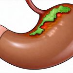 Digestive Breakdown During High-Output Work Weeks