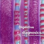 Digestive diagnostics that go beyond colonoscopy
