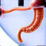 First-line assessments in patients with low stomach acid