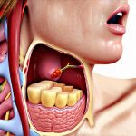 GERD and Chronic Hiccups: What’s the Connection?