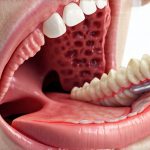 GERD and Clicking or Popping in the Throat