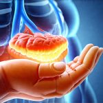 GERD and Flare-Ups During Stressful Events