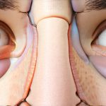 GERD and Sinus Pressure: Understanding the Relationship