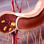 GERD Symptoms That Appear Without Eating Anything