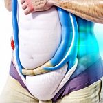 How Constipation Backlog Contributes to Upper Abdominal Gas