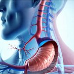 How GERD Can Lead to Esophageal Strictures Over Time