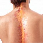 How Gut Health Influences Skin Issues and Bloating