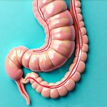 How Gut Infections Can Lead to Persistent Bloating