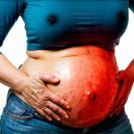 How Menopause Affects Bloating and Gut Sensitivity
