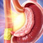 How Reflux Symptoms Vary by Time of Day — and Why