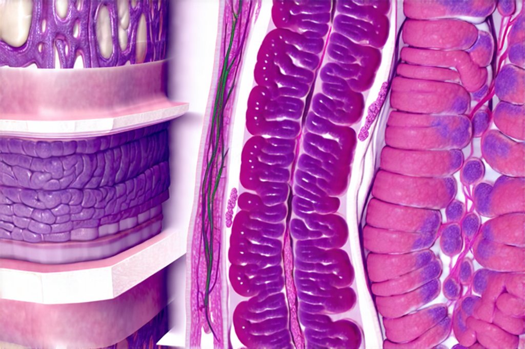How scan results evolve over time in chronic gut issues