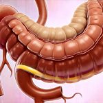How to Distinguish Between Stomach and Colon Gas