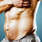 How to Recognize and Treat Functional Bloating