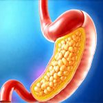 How to test for stomach acid without invasive tools