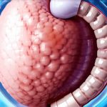 Is a capsule endoscopy better than a regular one