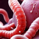 Is H. pylori Infection Related to GERD or Reflux?