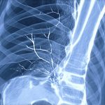 Medical imaging used in detecting hidden bleeding