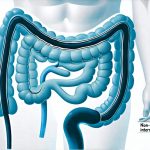 Non-invasive checks that reveal internal gut pressure