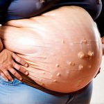 Signs That Your Bloating May Be Emotionally Driven
