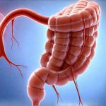 Signs you might need a colonoscopy earlier than expected