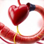 Simple Lifestyle Shifts That Make a Big Impact on Heartburn