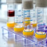 Smart approaches to finding food triggers through testing