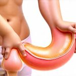 Testing procedures for recurring diarrhea episodes