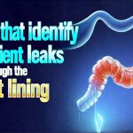 Tests that identify nutrient leaks through the gut lining