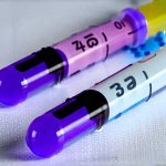 Tests used to confirm enzyme deficiencies