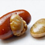 The Connection Between Gallstones and Chronic Bloating