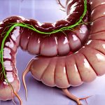 The Effects of Environmental Toxins on Gut Gas Levels