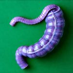 The link between frequent burping and digestive inflammation