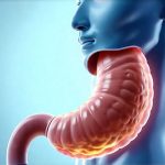 The Link Between Silent Reflux and Bloating