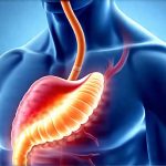 The Relationship Between Gas and Acid Reflux Explained