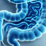 The Relationship Between Leaky Gut and Digestive Gas