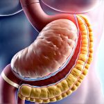 The Role of Bile Reflux in GERD-Like Symptoms
