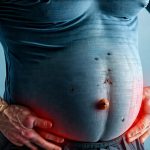The Role of Hormones in Male Bloating Patterns