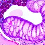 The Role of Mucosal Health in Digestive Sensitivity