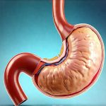 Tools for understanding delayed gastric emptying