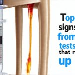 Top early signs from stool tests that need follow-up