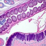 Top tests for tracking gut repair after illness